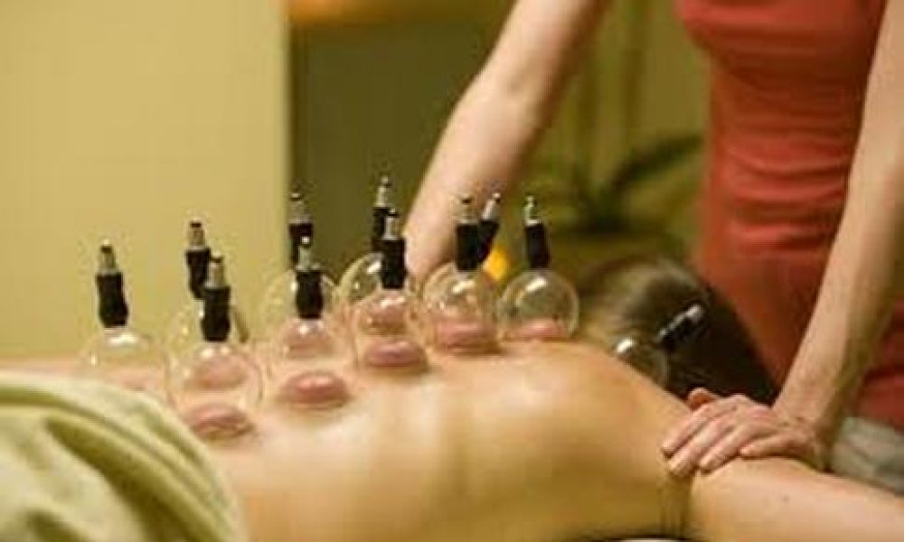 Ask the Experts: What is Cupping and How Can It Enhance Your Health?
