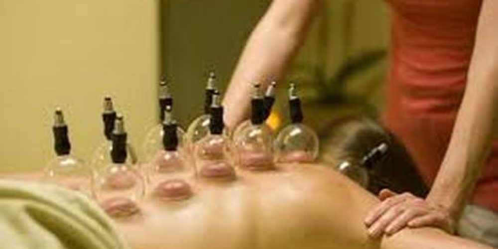 Ask the Experts: What is Cupping and How Can It Enhance Your Health?